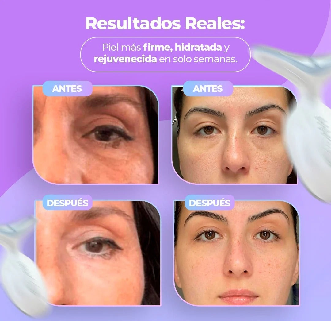 Masajeador Facial - Terapia de Luz Facial Antienvejecimiento 7 en 1